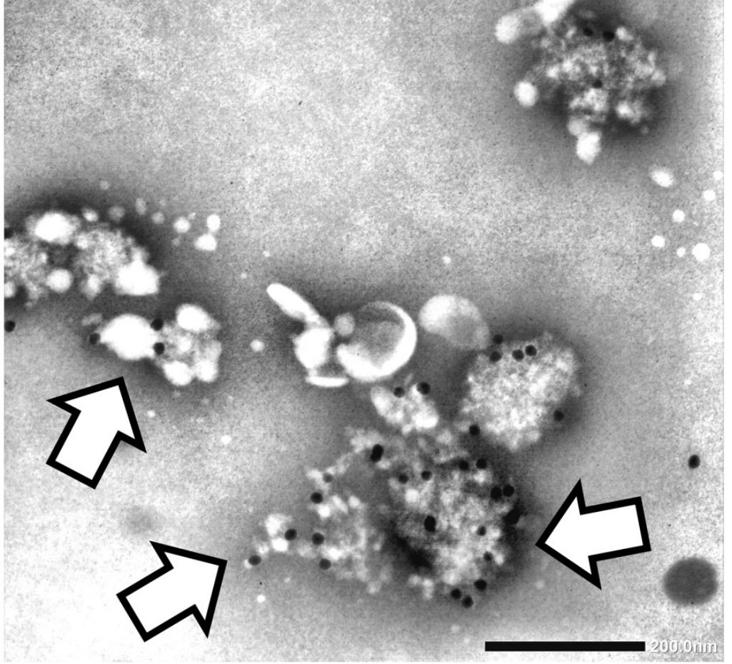 Immuno-EM image showing payload labeling